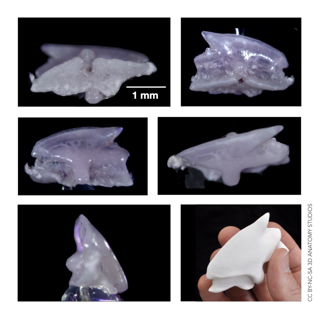 A series of photos of a dogfish shark tooth viewed under a dissection scope and a photo of a 3D printed dogfish shark tooth model held in a hand