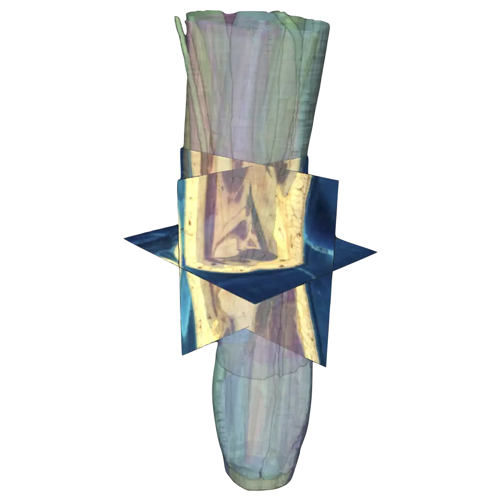 Screenshot of knee segmentation with muscles and cryosection images in partial transparency